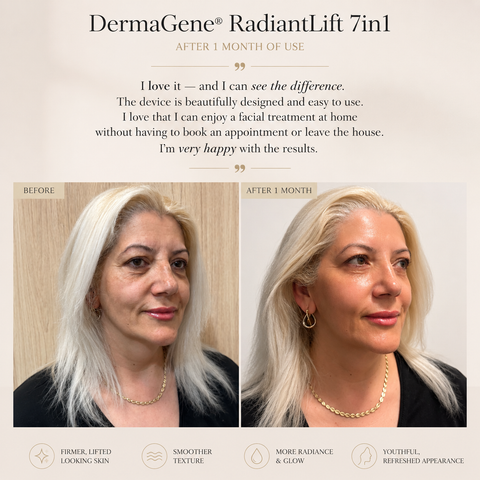 DermaGene® RadiantLift 7v1 RF & EMS přístroj na lifting obličeje