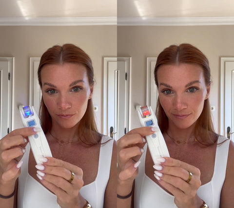 DermaGene® MicroLuxe – přístroj pro mikrojehličkovou terapii 4 v 1 s LED a mikroproudem