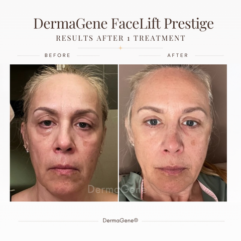 PRESTIGE Ultimate Face Sculpt Ritual