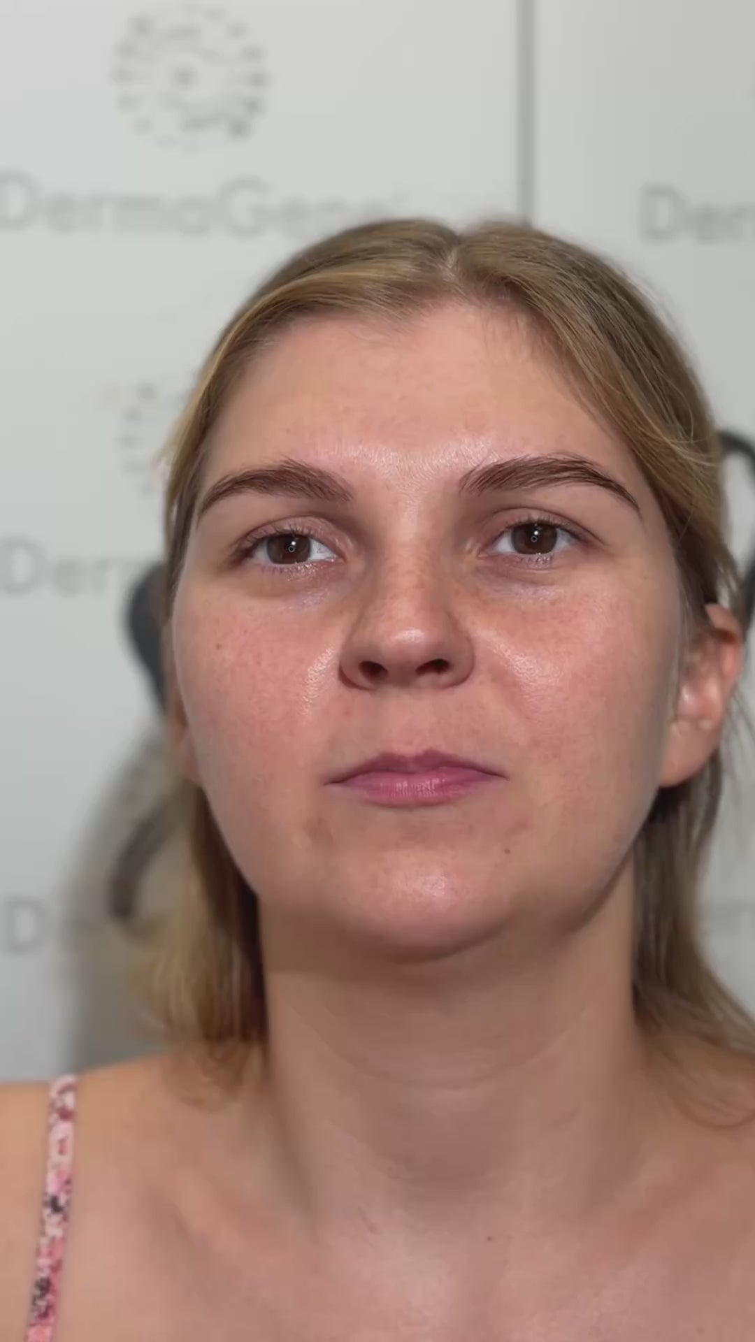 DermaGene® KROK 3 BIO-RECODE™ NAD+ PDRN Bio-Kolagenový Týdenní Obnovující Maska